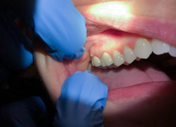 Best After-Hours Emergency Dentist in Chamberlayne, VA